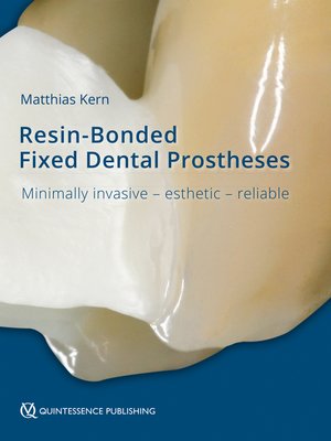cover image of Resin-Bonded Fixed Dental Prostheses